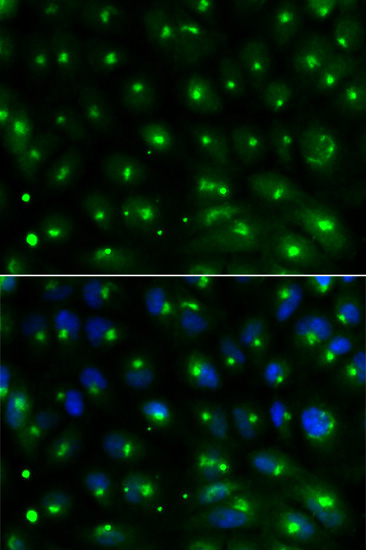 Immunofluorescence analysis of MCF-7 cells using GGA2 Polyclonal Antibody Blue: DAPI for nuclear staining.