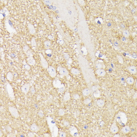 Immunohistochemistry of paraffin-embedded Mouse brain using SEPT5 Polyclonal Antibody at dilution of  1:100 (40x lens).