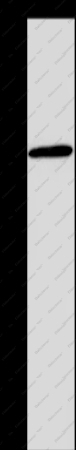Glucagon Receptor Polyclonal Antibody - 1