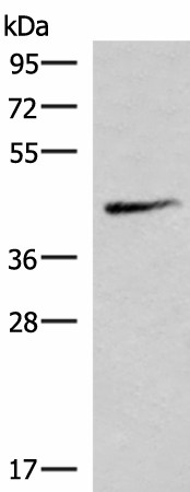 Western blot analysis of Mouse lung tissue lysate  using SMPD2 Polyclonal Antibody at dilution of 1:1000