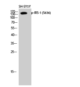 Western Blot analysis of SH-SY5Y cells using Phospho-IRS1 (Ser636) Polyclonal Antibody at dilution of 1:2000