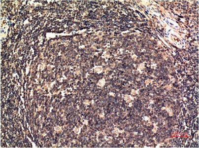 Immunohistochemistry of paraffin-embedded Human tonsil tissue using ERK 1 Monoclonal Antibody at dilution of 1:200.