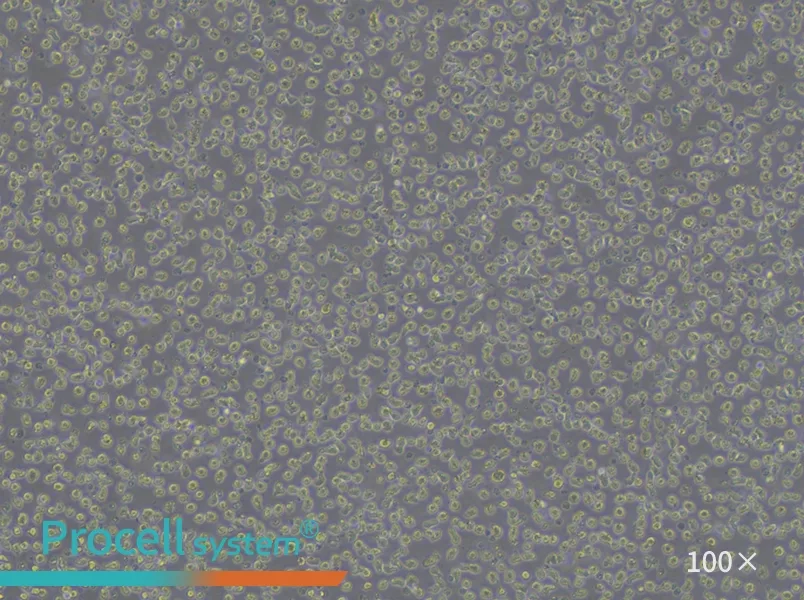 JeKo-1 Cell Complete Medium - 1