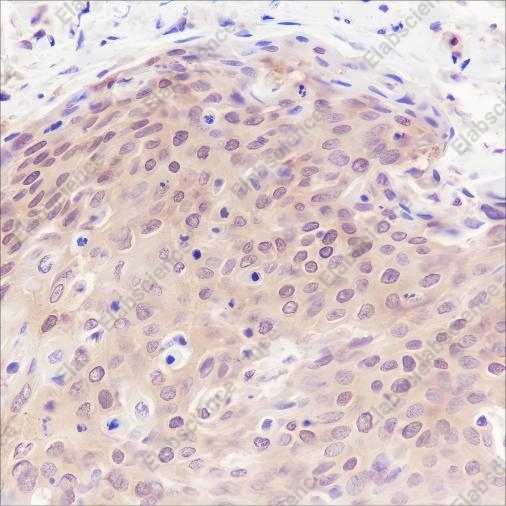 Recombinant PPP1CB Monoclonal Antibody - 2