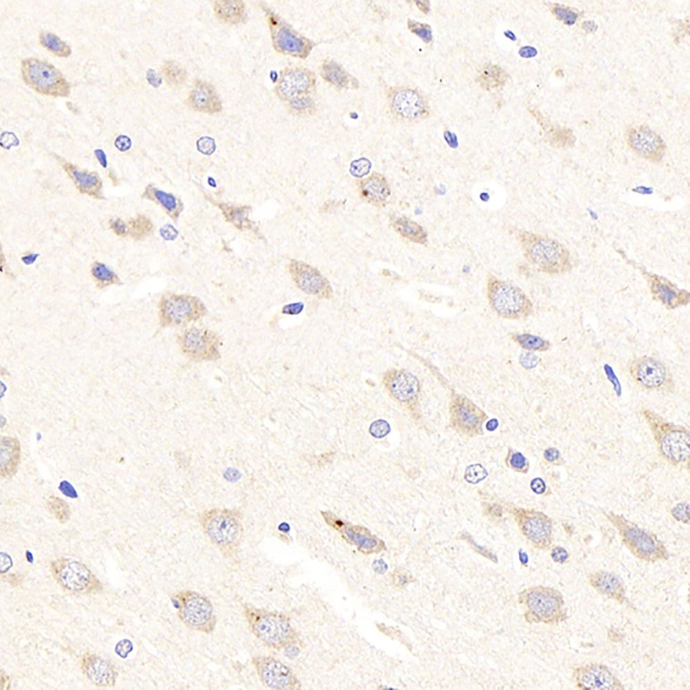 Immunohistochemistry analysis of paraffin-embedded rat brain  using NTRK2 Polyclonal Antibody at dilution of 1:300.