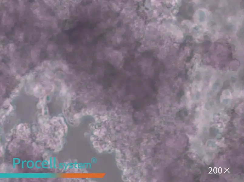 NCI-H660 Cell Complete Medium - 4