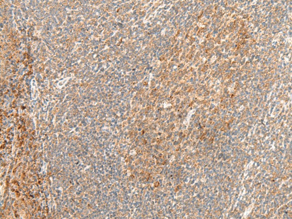 Immunohistochemistry of paraffin-embedded Human tonsil tissue  using GPR62 Polyclonal Antibody at dilution of 1:40(?200)