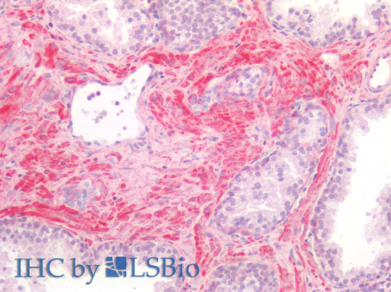 Immunohistochemistry of paraffin-embedded Human Smooth Muscle using BMP4 Polyclonal Antibody at dilution of 1:70(Elabscience Product Detected by Lifespan).