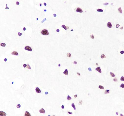 Recombinant Histone H3 (CT) Monoclonal Antibody - small - 6