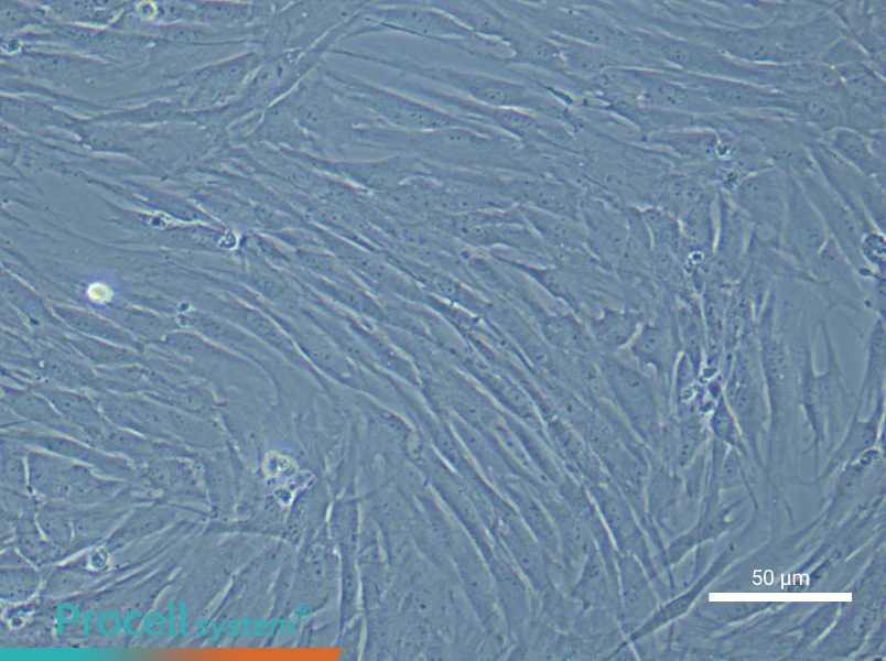 Human Pulmonary Artery Smooth Muscle Cell Complete Medium - 5