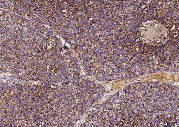 Recombinant SOD2 Monoclonal Antibody - small - 4