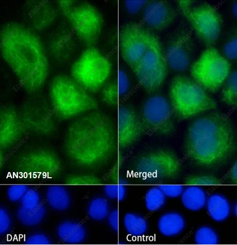 Recombinant Keratin 4 Monoclonal Antibody - 2