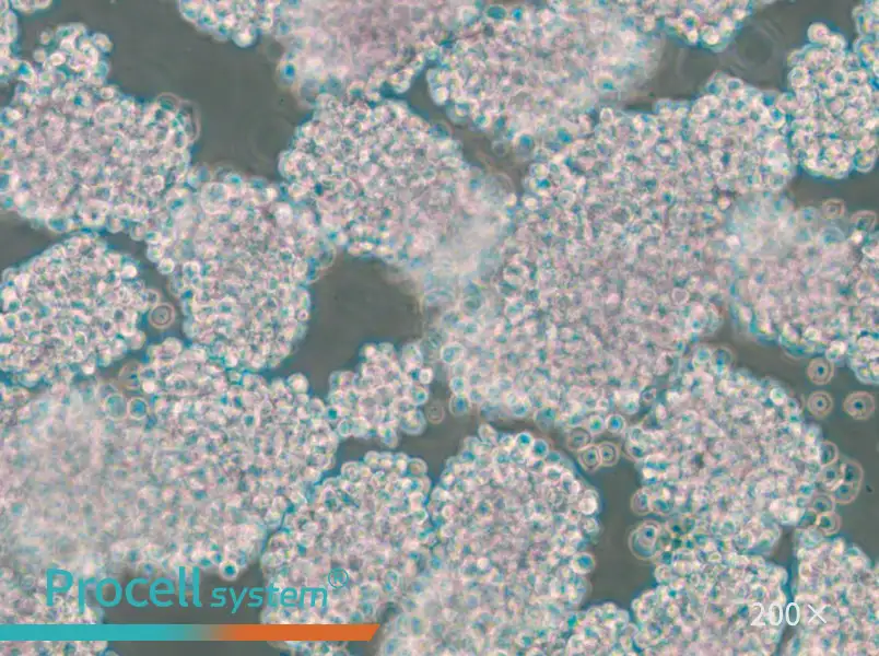 HuT 102 Cell Complete Medium - 4