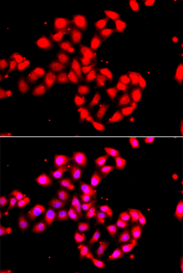 Immunofluorescence analysis of A549 cells using CAMK1D Polyclonal Antibody