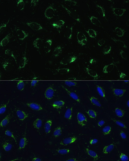 Immunofluorescence analysis of U-2 OS cells using COX5B Polyclonal Antibody at dilution of  1:100. Blue: DAPI for nuclear staining.