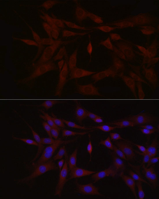 Immunofluorescence analysis of PC-12 cells using TYK2 Polyclonal Antibody at dilution of 1:100 (40x lens). Blue: DAPI for nuclear staining.