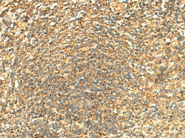 Immunohistochemistry of paraffin-embedded Human tonsil tissue  using ABHD10 Polyclonal Antibody at dilution of 1:50(?200)