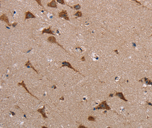 Immunohistochemistry of paraffin-embedded Human brain tissue using POMT1 Polyclonal Antibody at dilution 1:40