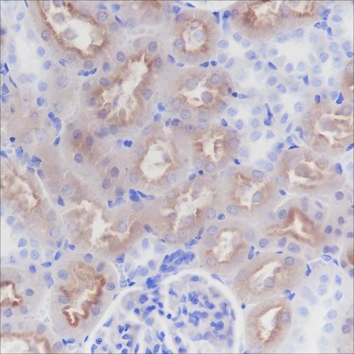 Recombinant CD13 Monoclonal Antibody - small - 5