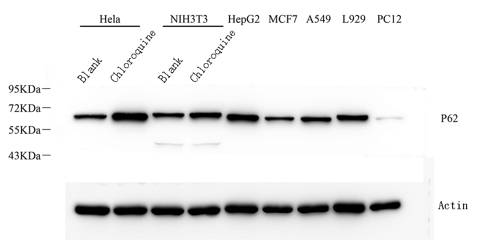 Western Blot analysis of various samples using P62/SQSTM1 Polyclonal Antibody at dilution of 1:1000.