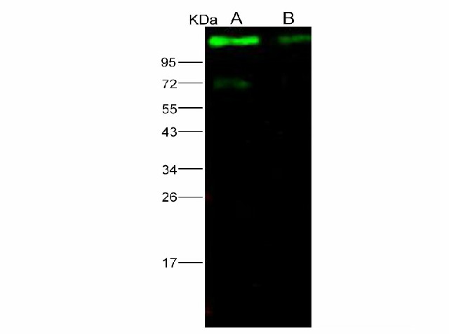 Western Blot analysis of Recombinant EBOV (Subtype Sudan, strain Gulu) Glycoprotein / GP1 (mucin domain deleted) Protein (His Tag)(PKSV030141 with 20ng and 5ng) using Anti-Ebola virus EBOV(Subtype Sudan, strain Gulu) Glycoprotein/GP1(mucin domain deleted) Monoclonal Antibody at dilution of 1:1000.