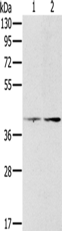 Western Blot analysis of Hela and lovo cell using PDGFRL Polyclonal Antibody at dilution of 1:400