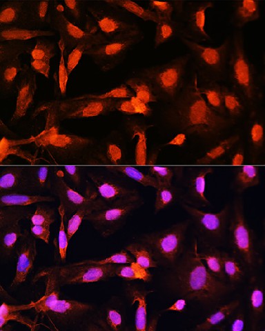 Immunofluorescence analysis of U20S cells using SGOL1 Polyclonal Antibody at dilution of  1:100. Blue: DAPI for nuclear staining.