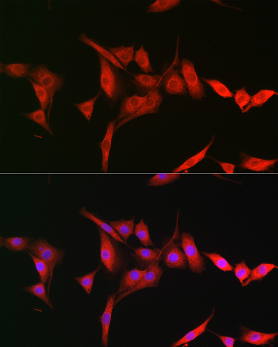 Immunofluorescence analysis of NIH-3T3 cells using TRIM31 Polyclonal Antibody at dilution of 1:200 (40x lens). Blue: DAPI for nuclear staining.