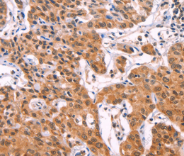 ST2 Polyclonal Antibody - 3