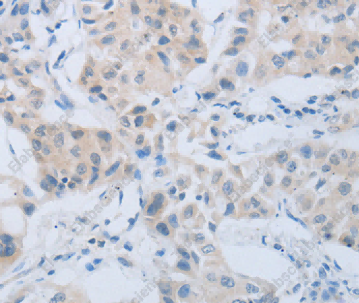 CD10 Polyclonal Antibody - 3