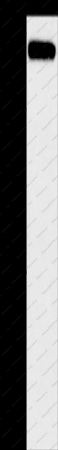 CBL Polyclonal Antibody - 1