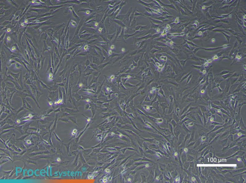 Mouse Gingival FibroblastsMouse Gingival Fibroblasts - 2