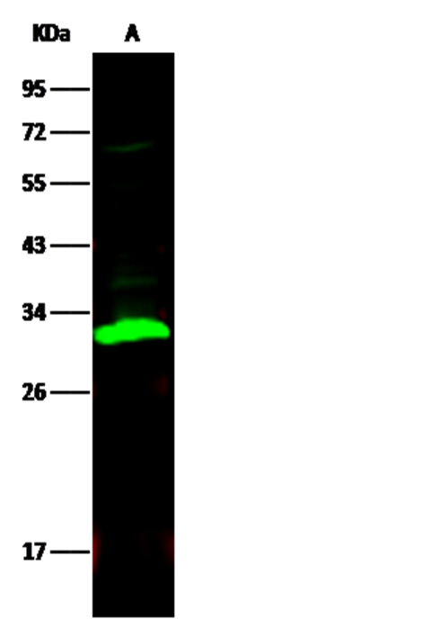 Recombinant Carbonic Anhydrase II/CA2 Monoclonal Antibody