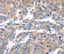 MYL9 Polyclonal Antibody - 2