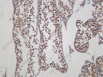 Recombinant Inhibin β-A Monoclonal Antibody - 2
