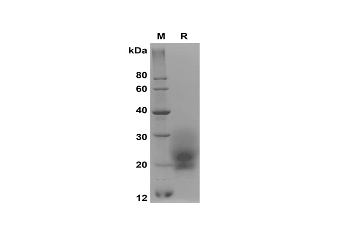 Recombinant Mouse TNFα Protein(His Tag)-产品推荐-1