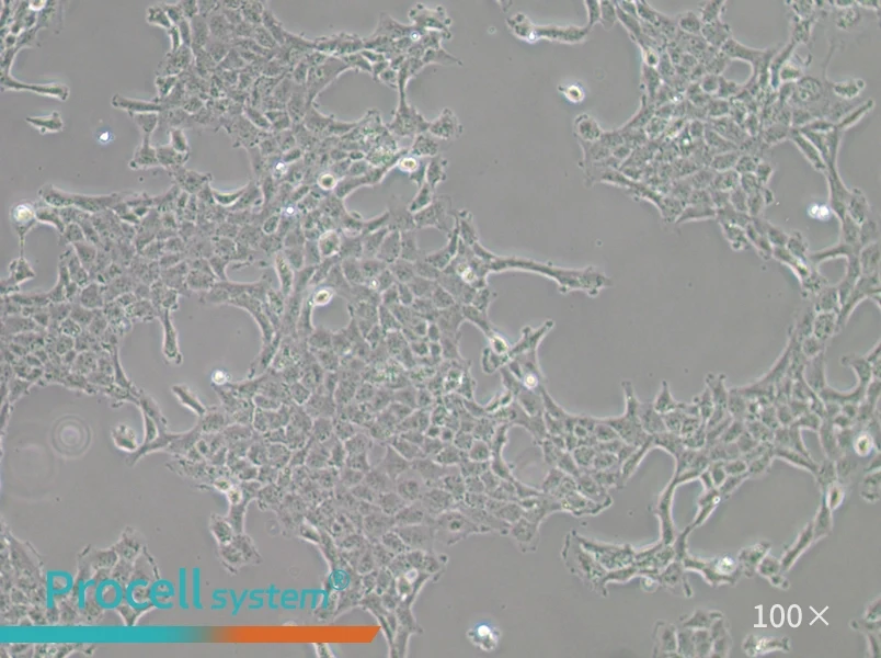 HBL-100 Cell Complete MediumHBL-100 Cell Complete Medium - 2