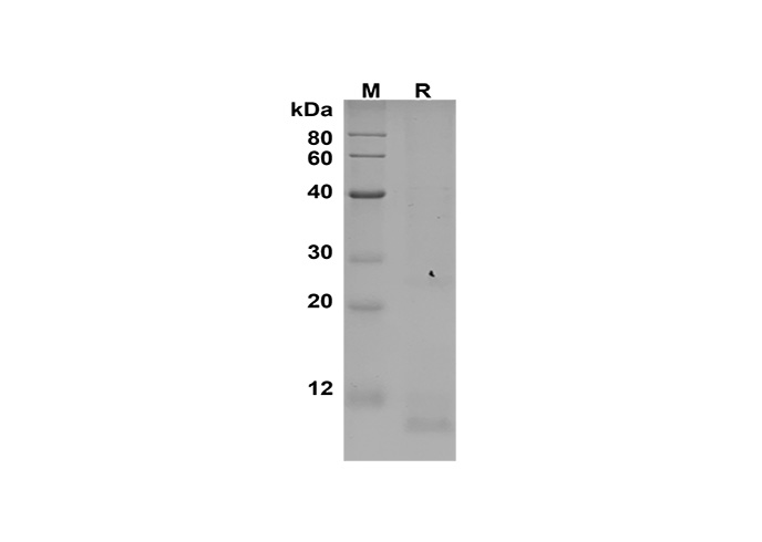 Recombinant Human MCSF Protein(GST Tag)-产品推荐-1