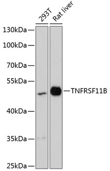 Western blot analysis of extracts of various cell lines using TNFRSF11B Polyclonal Antibody at dilution of 1:3000.