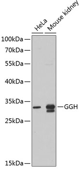 Western blot analysis of extracts of various cell lines using GGH Polyclonal Antibody at 1:1000 dilution.