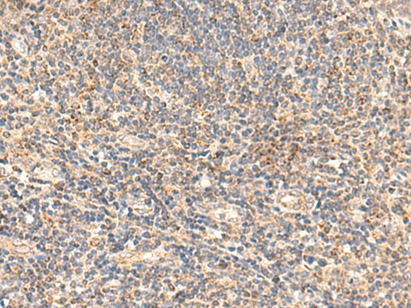 Immunohistochemistry of paraffin-embedded Human tonsil tissue  using GSTK1 Polyclonal Antibody at dilution of 1:50(?200)