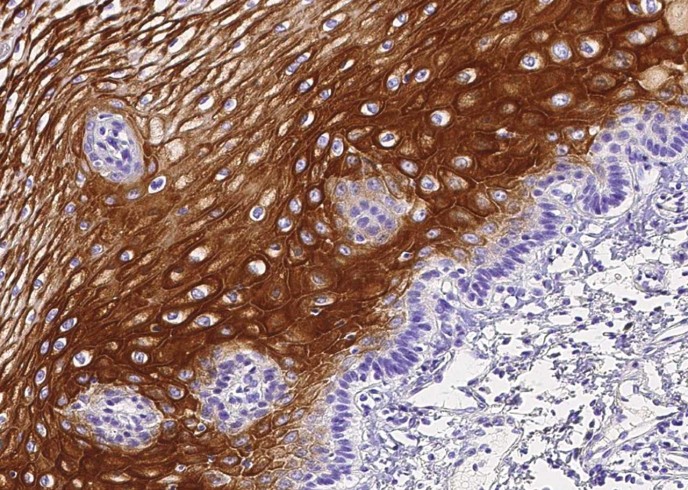 Recombinant IL36G/IL1F9 Monoclonal Antibody - small - 2