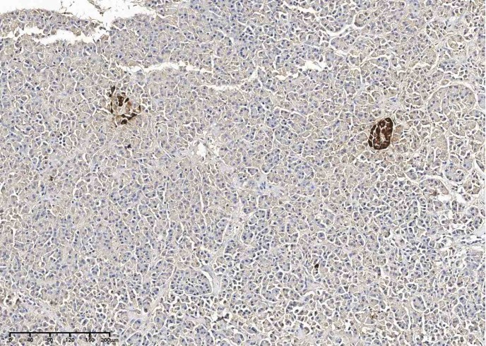 Recombinant GCG/Glucagon Monoclonal Antibody-searchlist-1