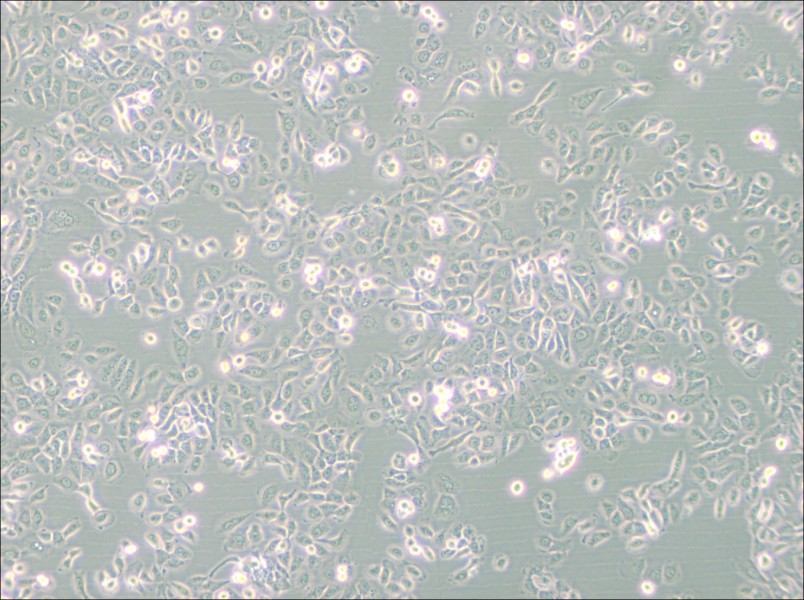 SUM149PT Cell Complete Medium - 2