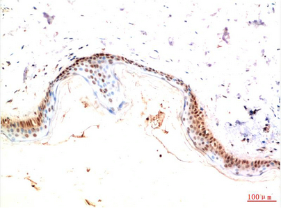 Immunohistochemistry of paraffin-embedded Human skin tissue using PDGFRA Monoclonal Antibody at dilution of 1:200.