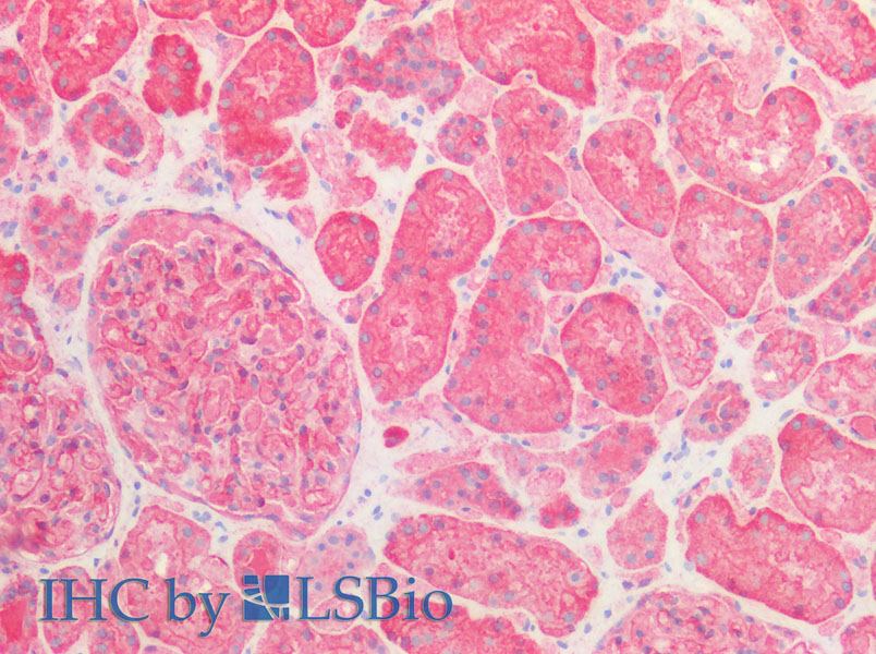 Immunohistochemistry of paraffin-embedded Human kidney using SPTAN1 Polyclonal Antibody at dilution of 1:100 (Elabscience Product Detected by Lifespan).