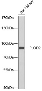 Western blot analysis of extracts of Rat kidney using PLOD2 Polyclonal Antibody at dilution of 1:1000.