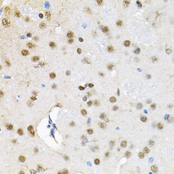Immunohistochemistry of paraffin-embedded Rat brain using BAF60a Polyclonal Antibody at dilution of 1:100 (40x lens).