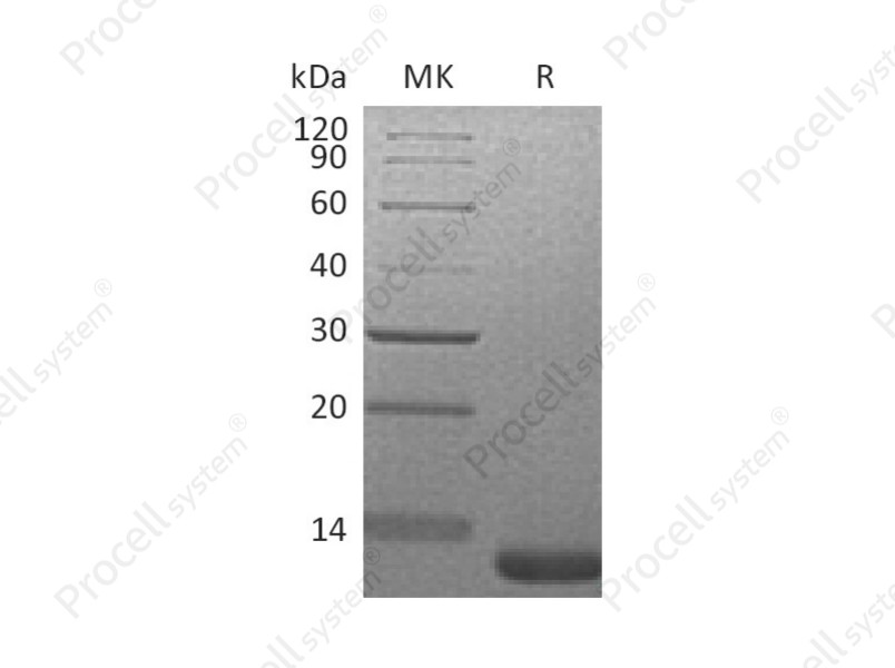 IGF-I/Somatamedin C/IGF-IA, Mouse, Recombinant