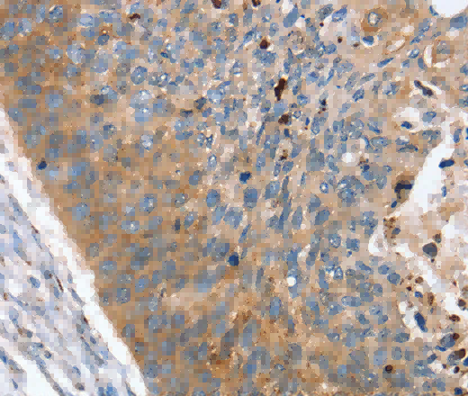 REG3A Polyclonal Antibody - 2